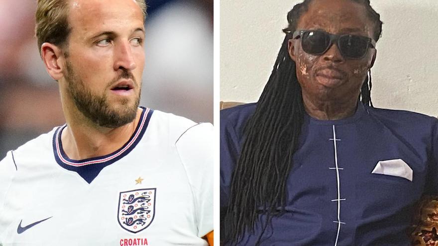 Un famoso brujo de Ghana amenaza a Harry Kane: asegura que ya provocó la lesión de Cristiano Ronaldo en un Mundial