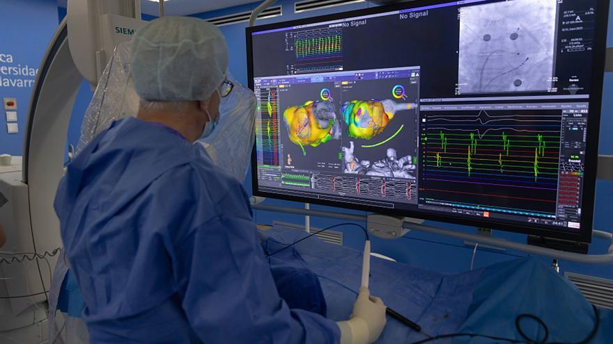 Primer paso en España: cardiólogos de Navarra investigan un método más eficaz y personalizado para tratar arritmias