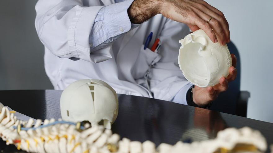 El arte de recomponer las malformaciones del cráneo de un bebé