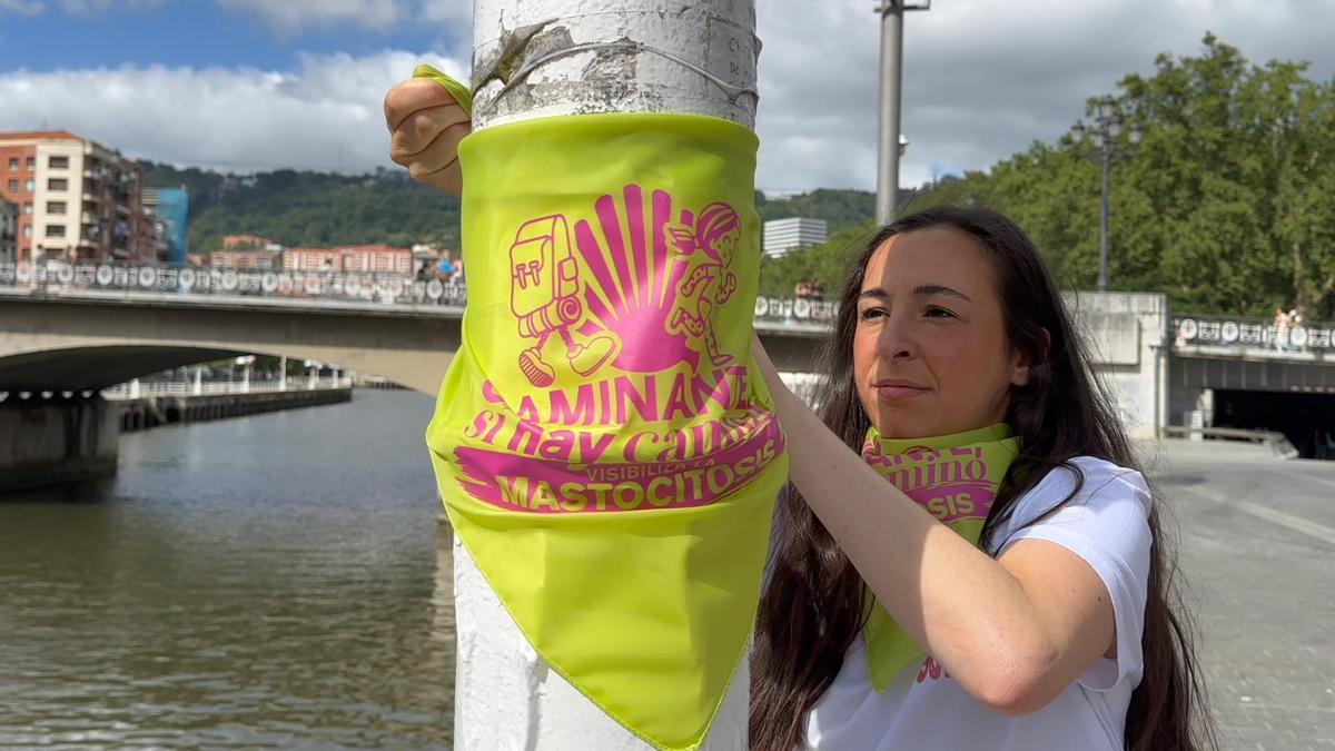 Sara Mirones, enferma de mastocitosis