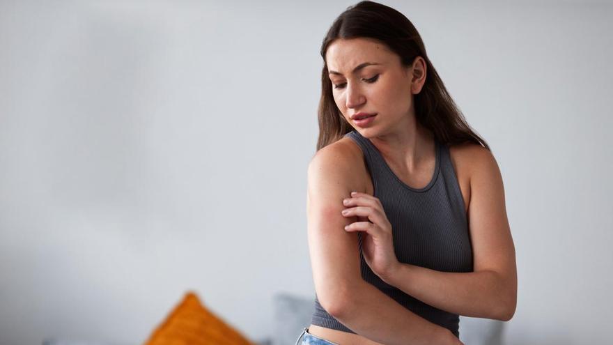 Los síntomas del lupus que deberían preocuparte