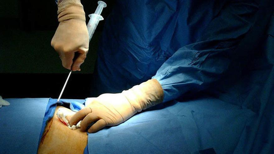 Los mayores de 40 años no podrán ya registrarse como donantes de médula