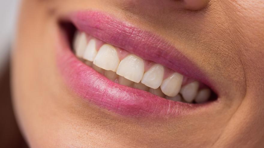 Aldi revoluciona la higiene bucodental: el limpiador que garantiza resultados profesionales