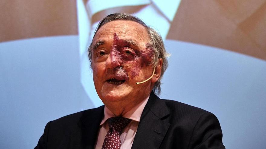 Denboraletik onik atera