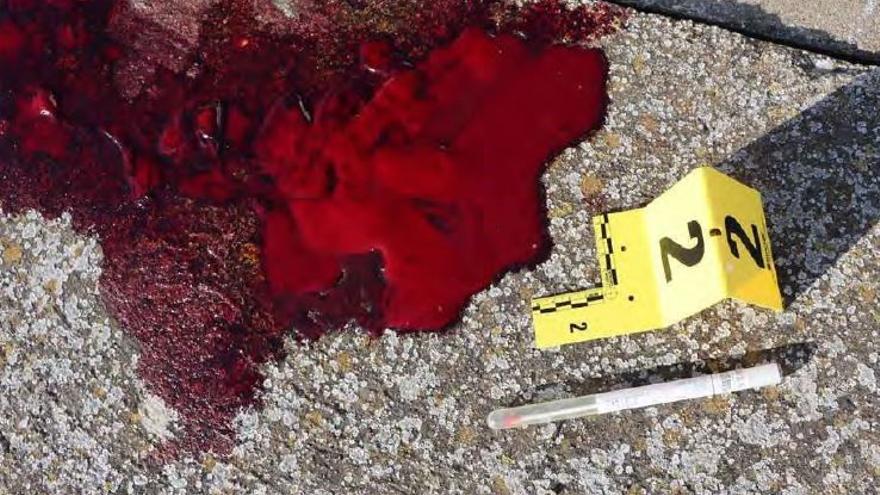 Restos de sangre de la víctima.