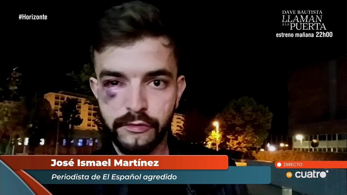 José Ismael Martínez, periodista agredido en Pamplona.
