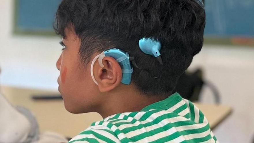 Un padre pide ayuda desesperada para recuperar el implante coclear robado a su hijo en la playa: &quot;Sin él no puede oír&quot;