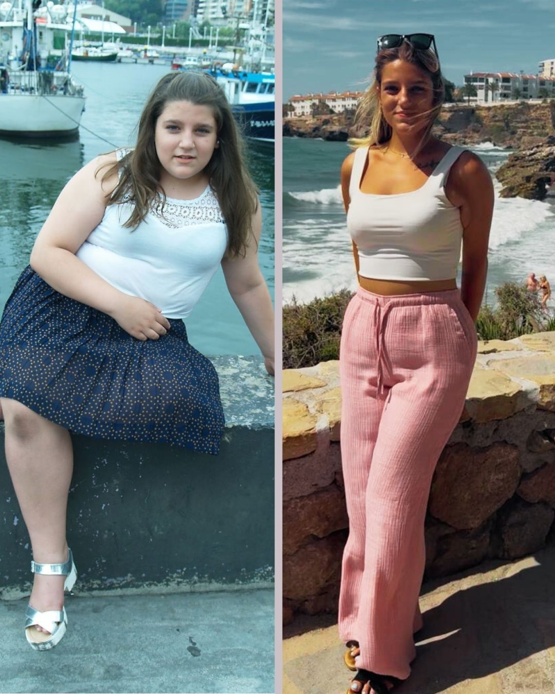 Olatz Plans decidió operarse cuando tenía 14 años.