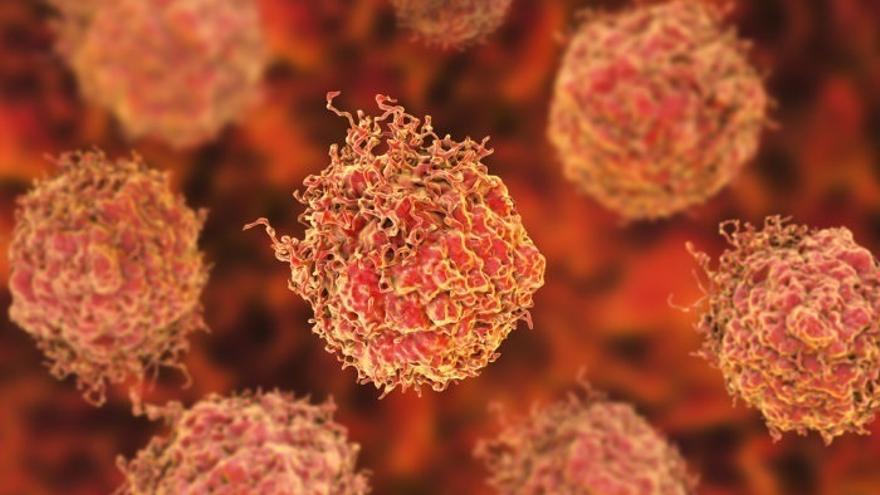 Imagen de las células de un paciente con cáncer de próstata.
