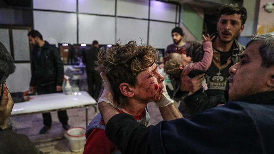 Niños heridos reciben ayuda en un hospital. Siria