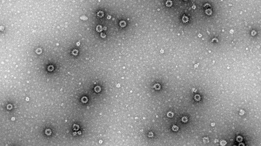 Más de 100 personas enfermas con norovirus en un crucero que zarpó de Florida