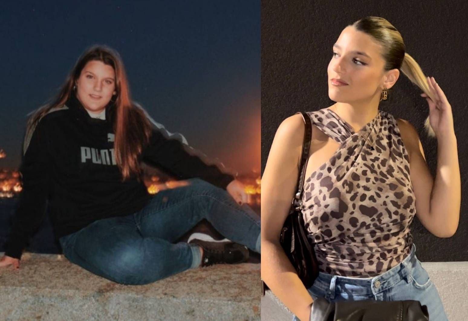 Olatz Plans adelgazó 40 kilos tras la cirugía.