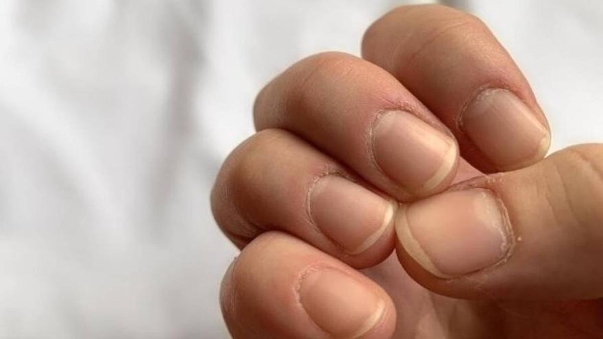 Las uñas