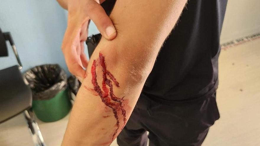Acude a la comisaría de Tudela por haber sido rociado con spray en los ojos y es detenido por una agresión