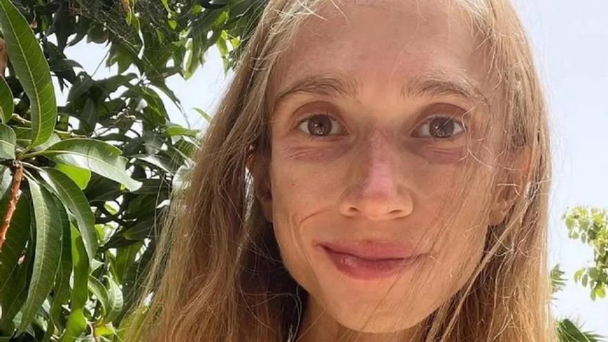 Muere una influencer vegana de 27 años que sólo comía fruta y apenas pesaba 22 kilos