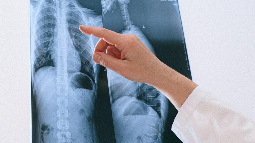 Un sistema pone cifras al impacto del cáncer en el Estado: los distintos tipos de tumores malignos, a examen