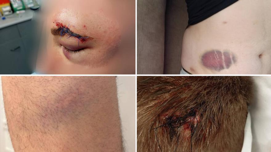 Sadar Bizirik pide a Echeverría que "rectifique" sus palabras por la carga policial en El Sadar