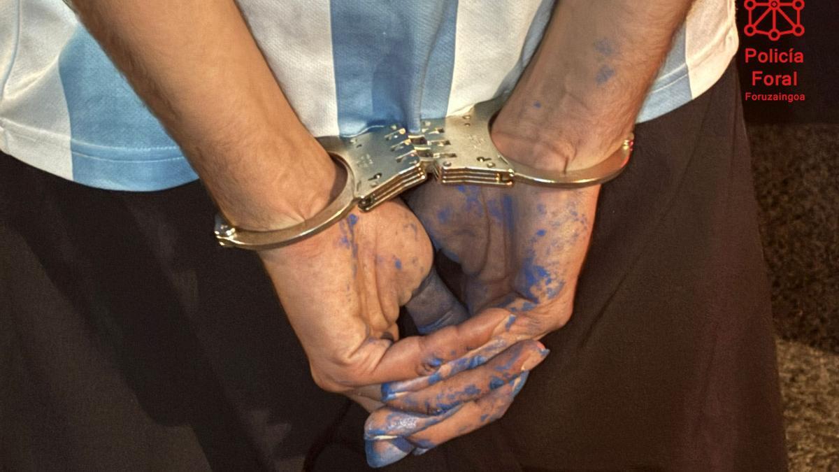 Manos con pintura del detenido en Alsasua.