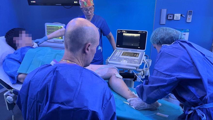 Láser endovenoso: la técnica que elimina las varices en una sesión