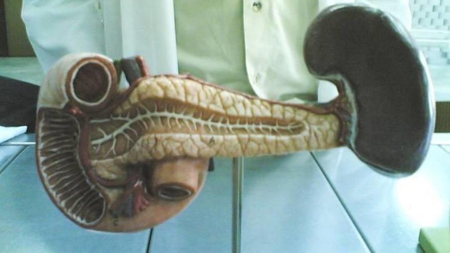 Un ensayo descubre que un fármaco podría ser eficaz para tratar el cáncer de páncreas