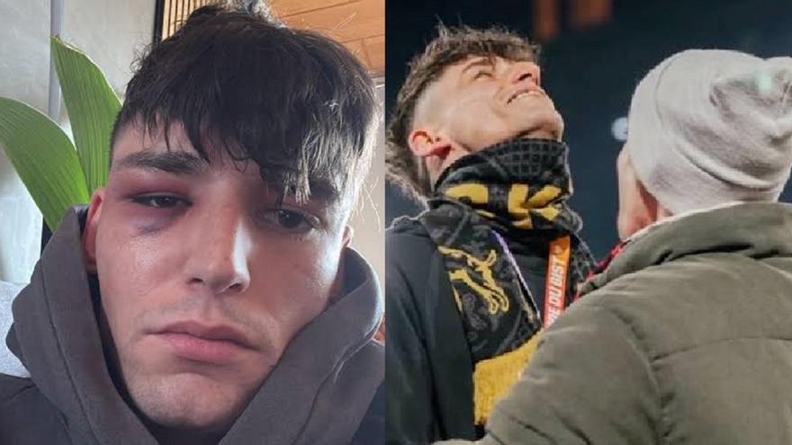 Tres hombres agreden en su casa al árbitro que pidió matrimonio a su novio en un partido de fútbol