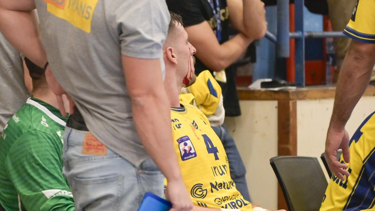 El jugador Irudek Bidasoa Irun Marko Jevtic, ensangrentado tras una acción ofensiva del Ademar de León en Artaleku