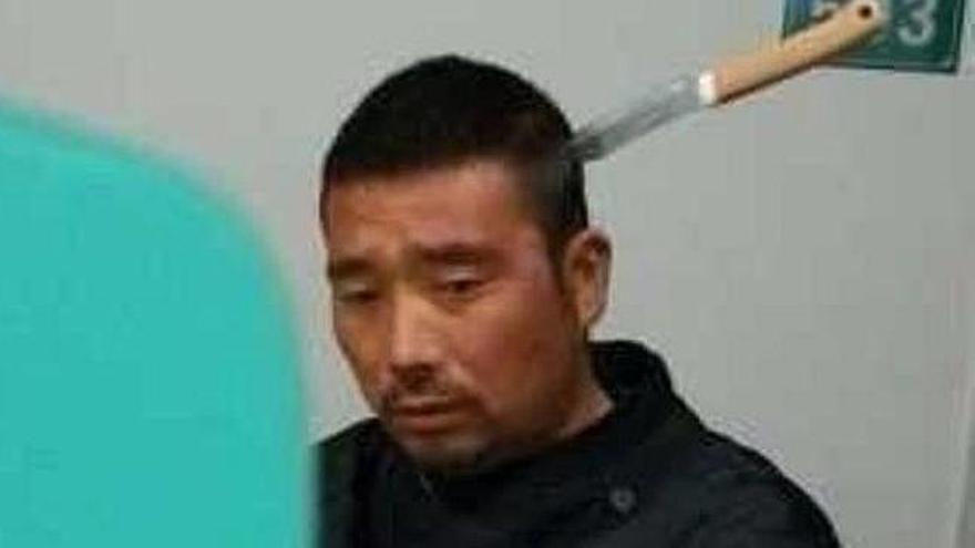 Un chino espera paciente su turno en un hospital con un cuchillo clavado en la cabeza