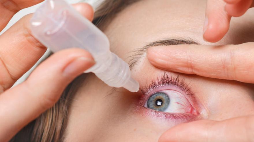 Las lágrimas artificiales puede ayudar a mantener la superficie ocular hidratada.
