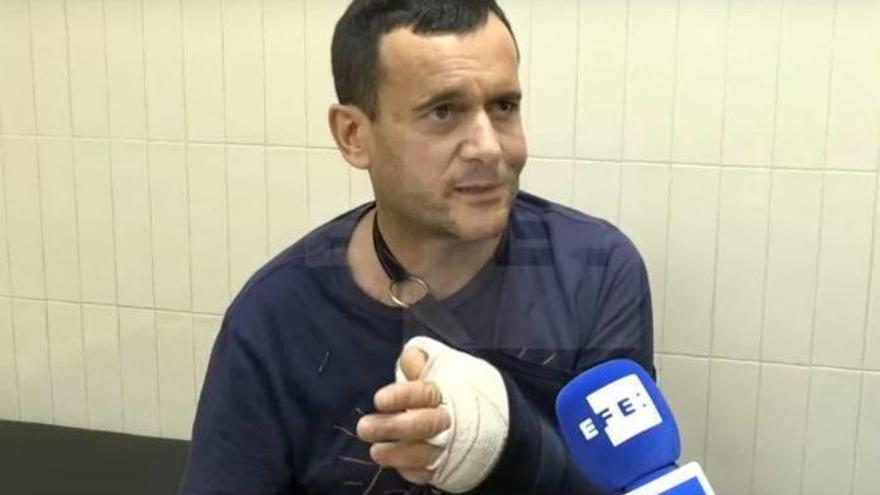 Recupera la funcionalidad de la mano con un dedo del pie.