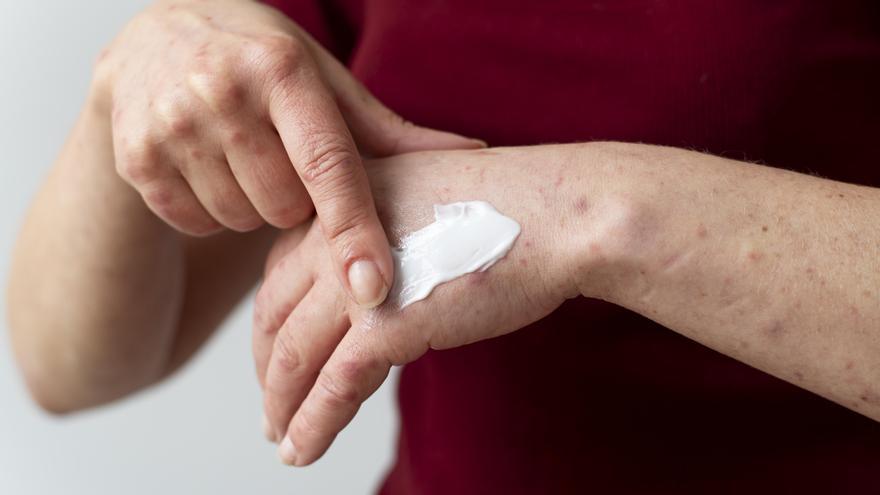 Sanidad retira varios productos para tratar heridas y quemaduras por riesgo de infección