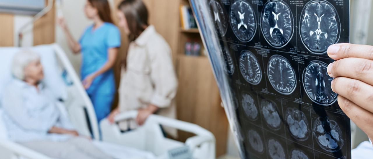 Detectados más de 6.000 nuevos casos de ictus al año en Euskal Herria