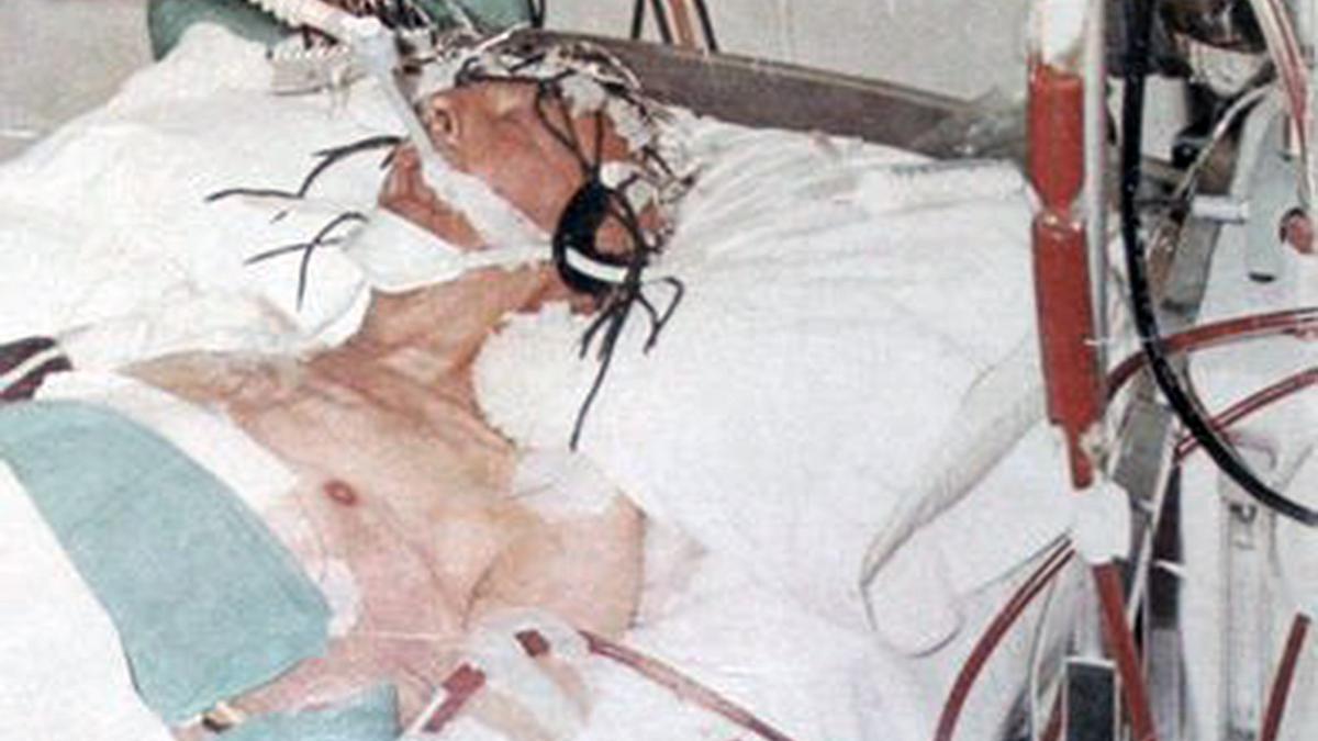 El dictador en su lecho de muerte; una imagen que burló la censura para hacerse célebre. El dictador en su lecho de muerte; una imagen que burló la censura para hacerse célebre.