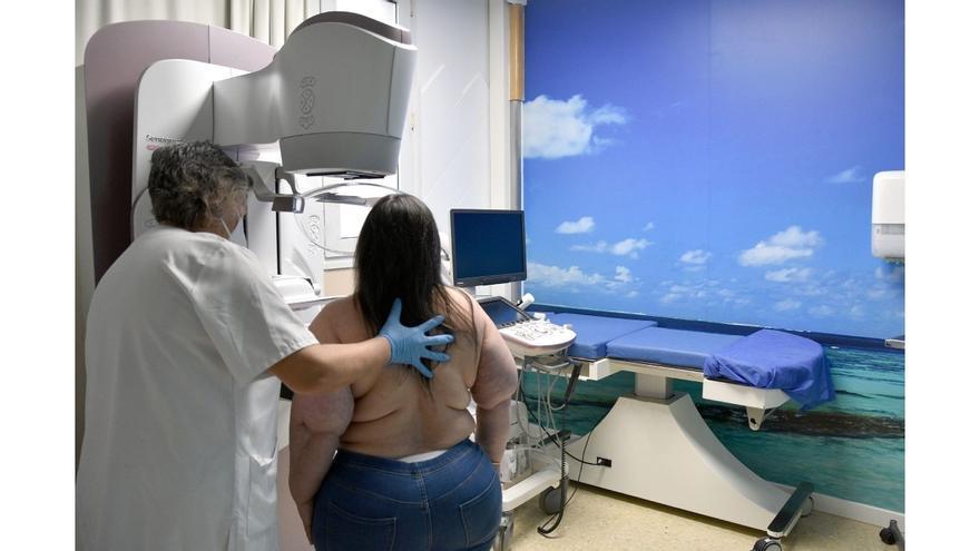 La radioterapia adaptada mantiene baja la recurrencia del cáncer de mama diez años después