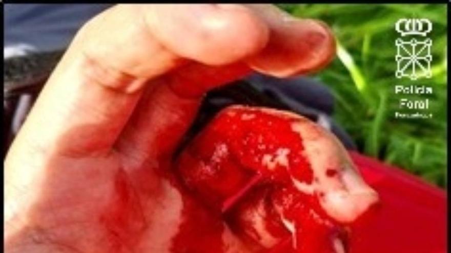 Persecución, fuga al monte y ataque a un policía: así fue el suceso en Uharte Arakil