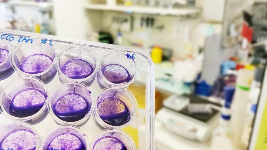 Científicos vascos avanzan en nuevas estrategias terapéuticas para el síndrome de Leigh