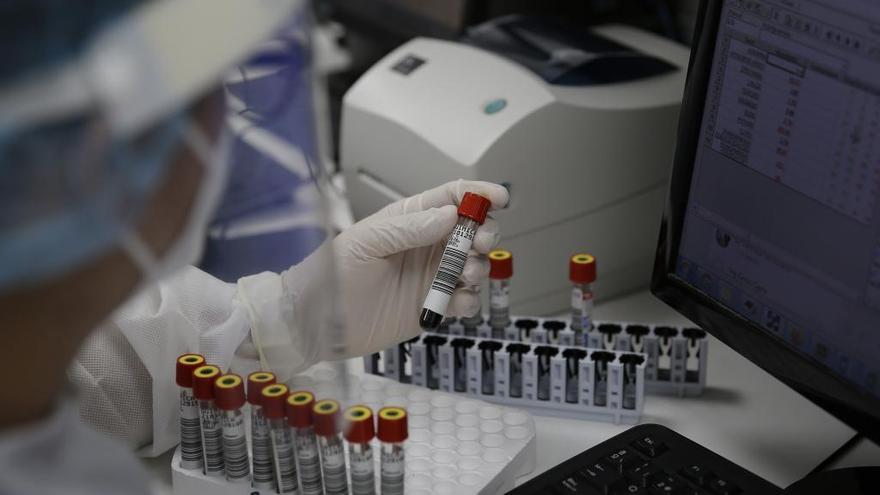 La pandemia deja ya 102 millones de contagios en todo el mundo
