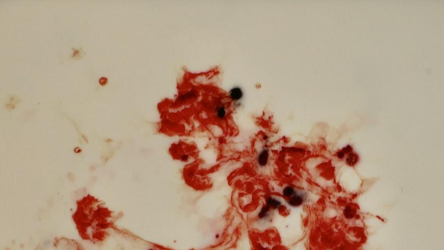 En imágenes: Exposición 'Úteros errantes'