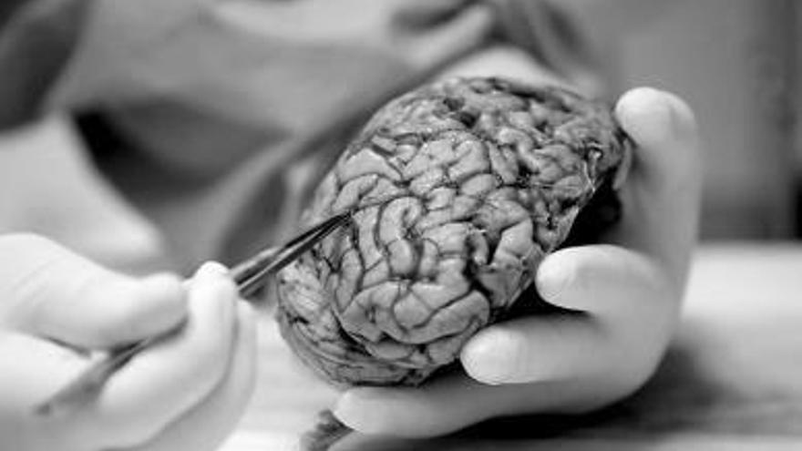 La donación de cerebros, imprescindible para entender el alzheimer