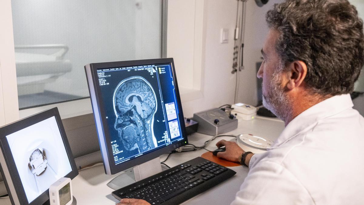 Un miembro del equipo que ha estudiado el impacto de la violencia machista en el cerebro.