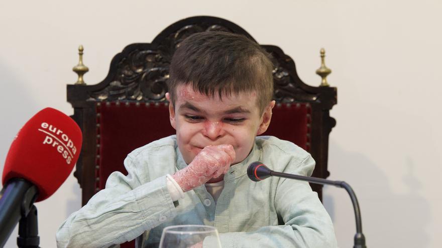 Terapia génica contra la 'piel de mariposa': dos jóvenes lideran el tratamiento pionero en el Estado