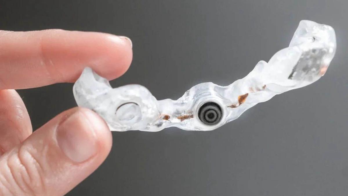 El dispositivo intraoral MouthX.