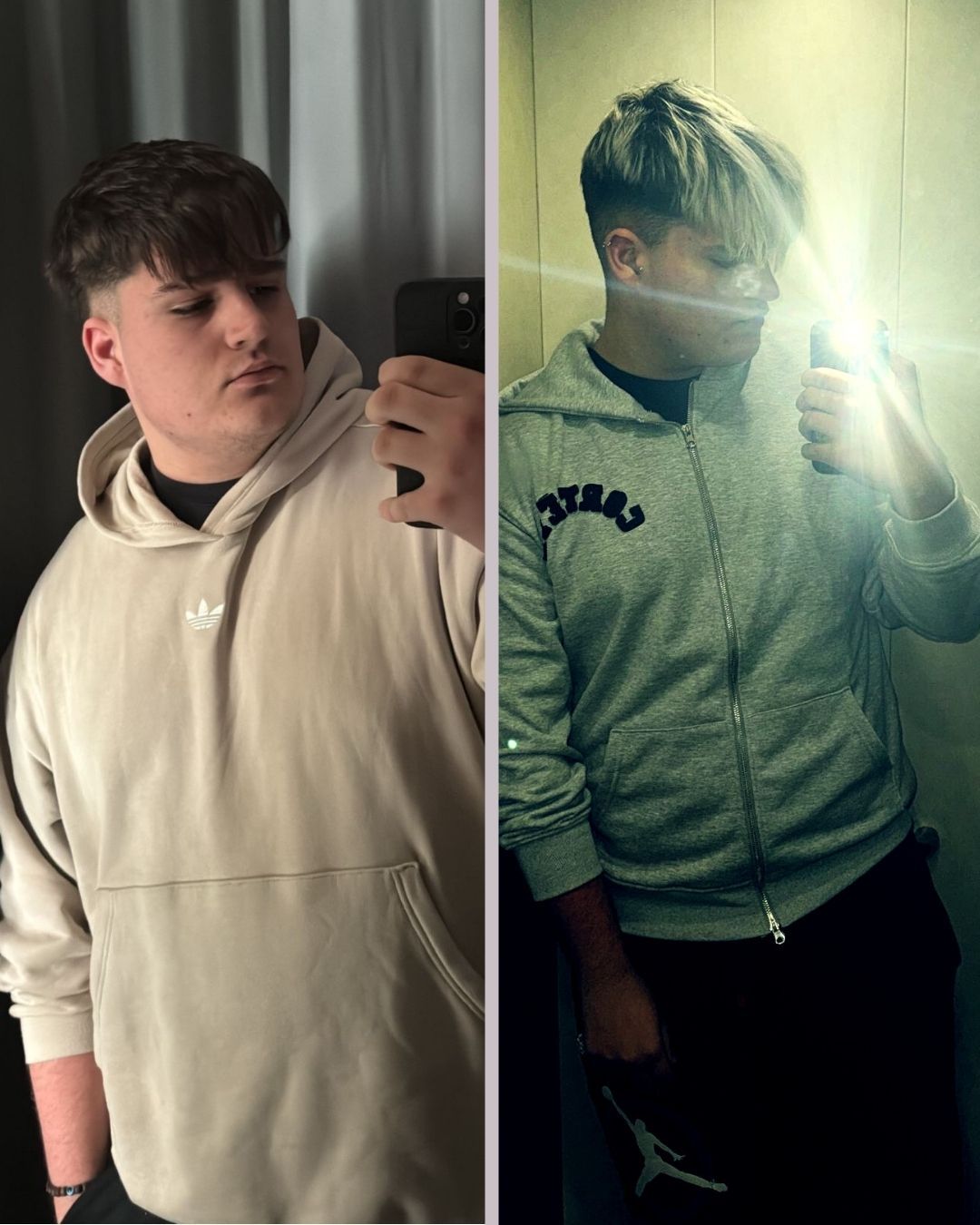 El antes y el después de Iñaki Plans, a solo unos días de operarse.