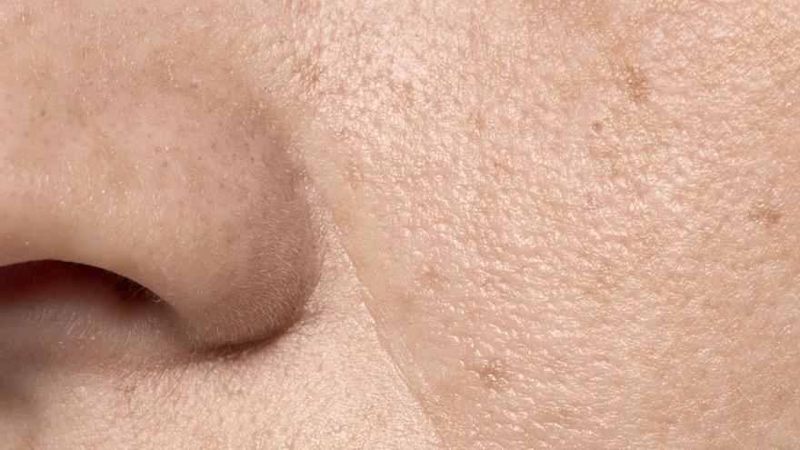 Adiós a los poros abiertos: la solución para lograr un cutis perfecto