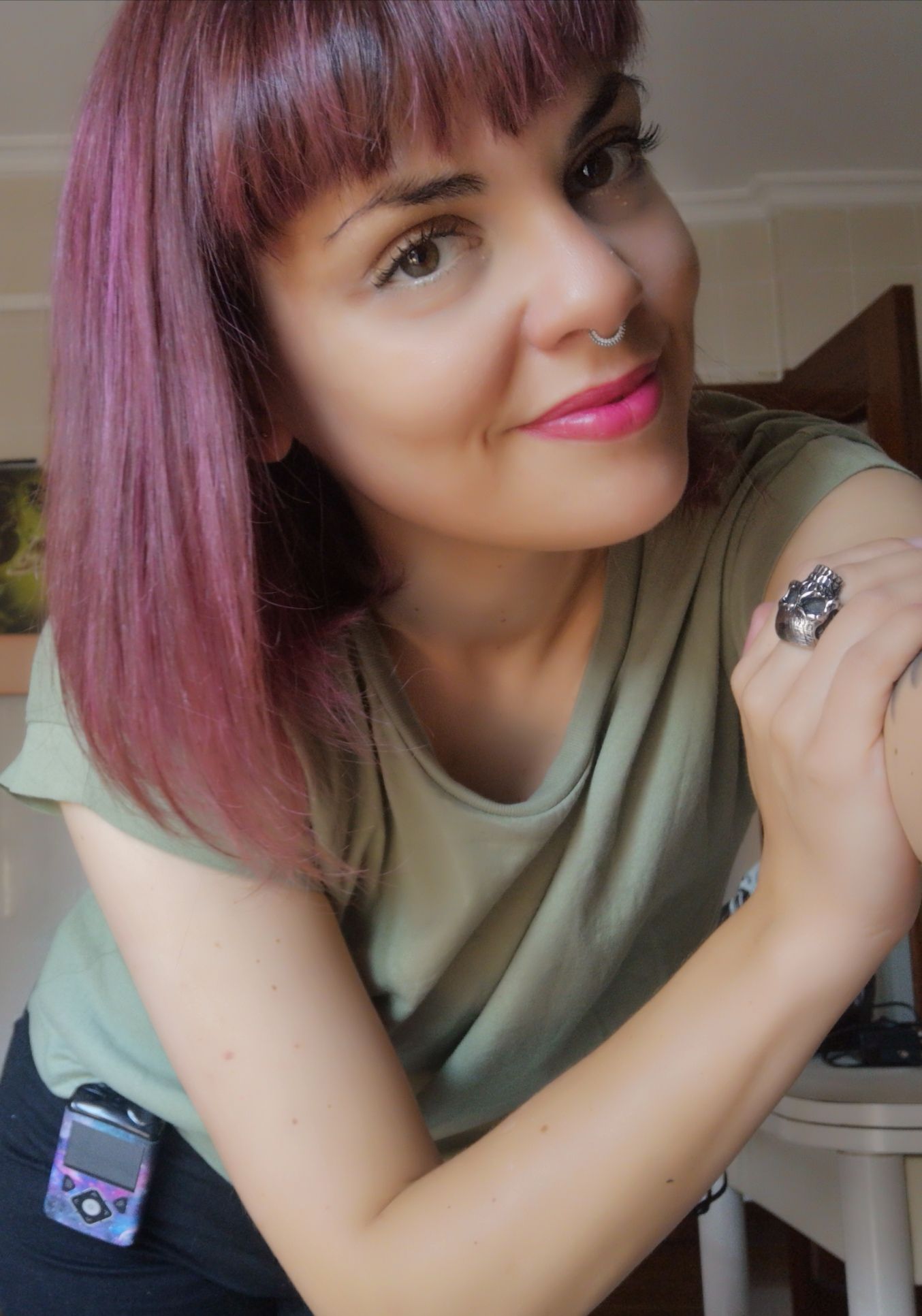 Nekane Alonso lleva una bomba de insulina para mantener niveles de glucosa en sangre más estables.