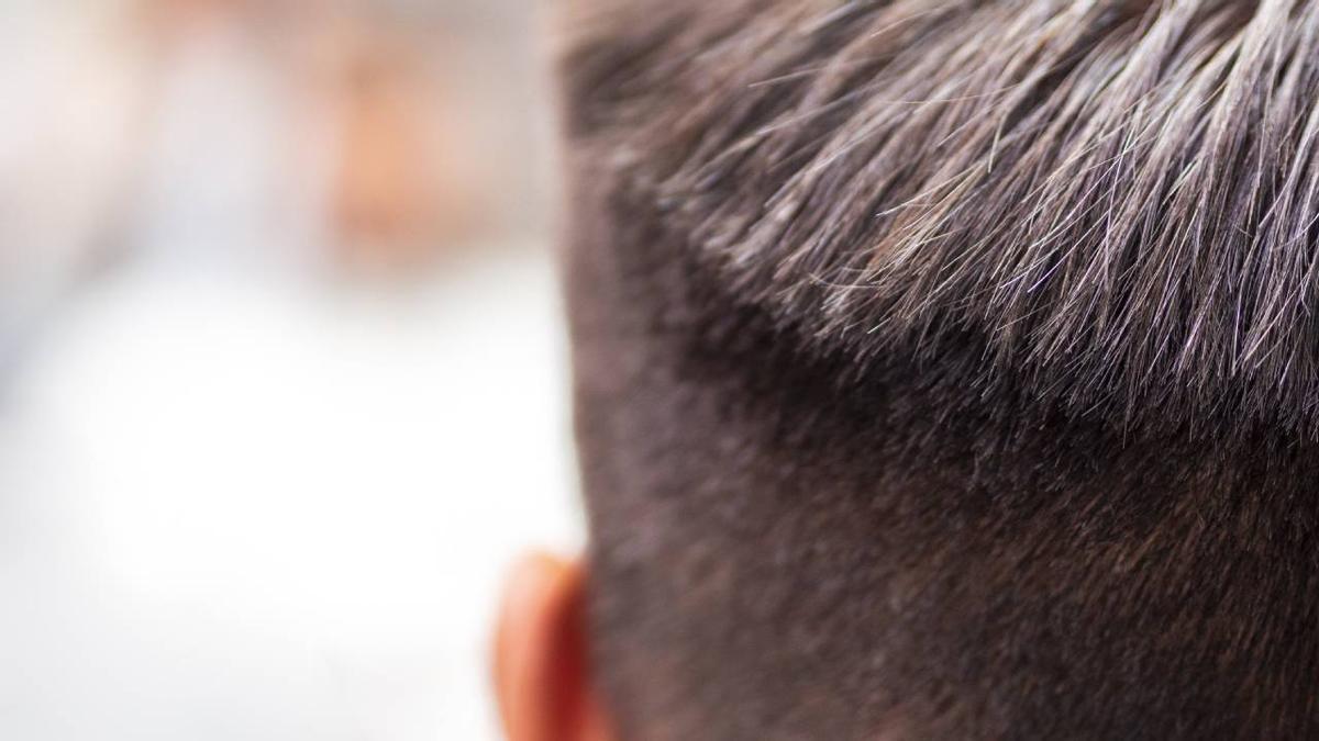 La clave de la dermatóloga Ana Molina para evitar la pérdida toda de cabello