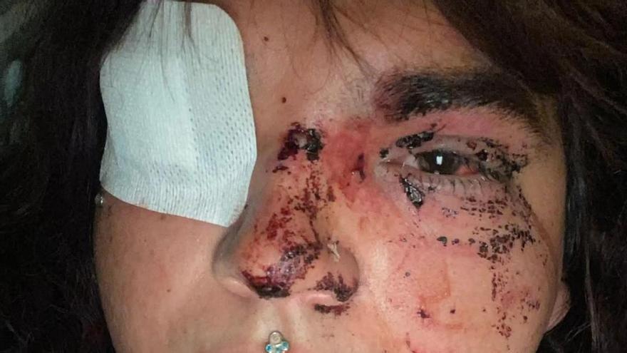 Miss Trans Zamora, brutalmente agredida al intentar acceder a un baño de mujeres en León