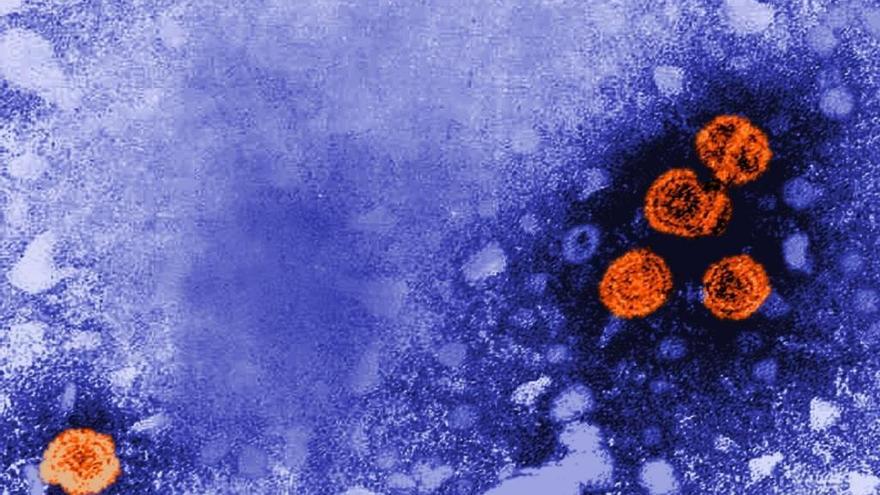 Imagen de microscopía electrónica de transmisión coloreada digitalmente revela la presencia de viriones de la hepatitis B