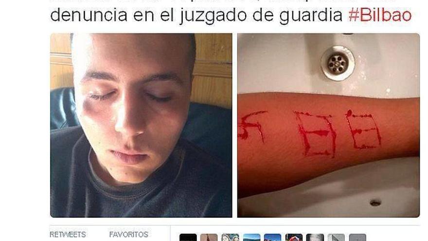 Neonazis agreden a un menor en Bilbao y le graban una esvástica en un brazo con una navaja