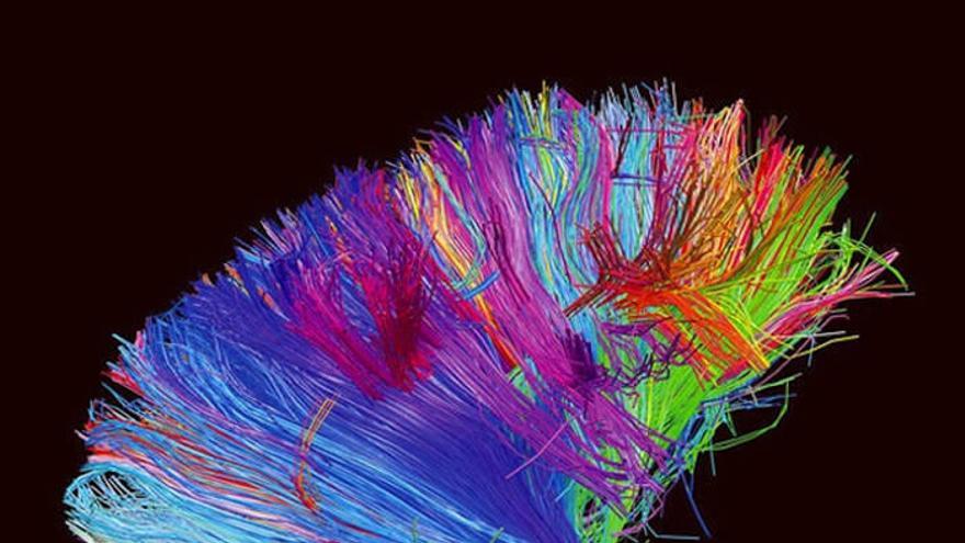 La portada del nuevo disco de Muse, &#039;The 2nd Law&#039;, muestra una fotografía del cerebro humano extraída del Proyecto del Conectoma Humano.