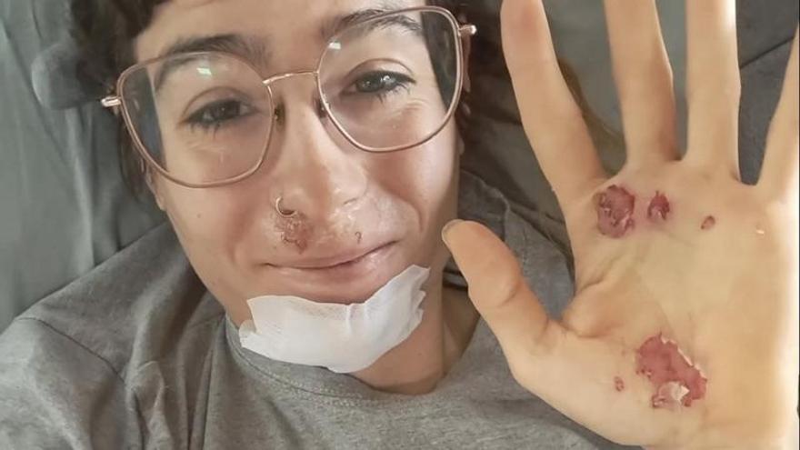 Sheyla Gutiérrez se recupera de las heridas tras el accidente.